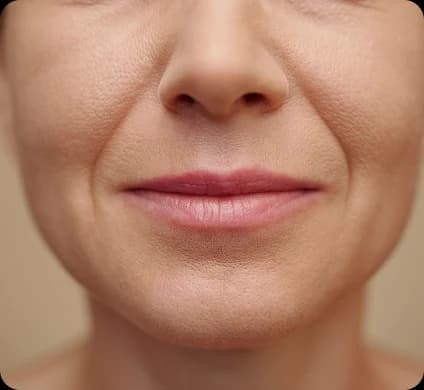 Anti-Aging Filler