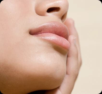 Chin Augmentation
