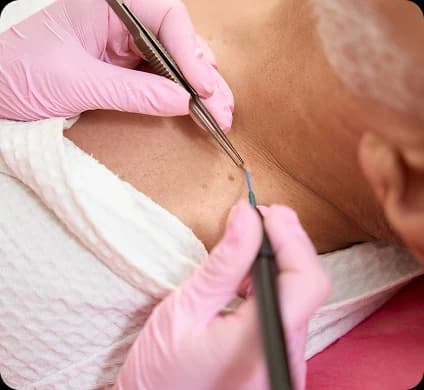 Extractions