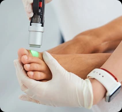 Nail Fungus Treatment
