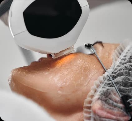Melasma & Hyperpigmentation