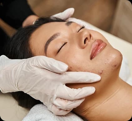 NeoClear® Acne Treatment