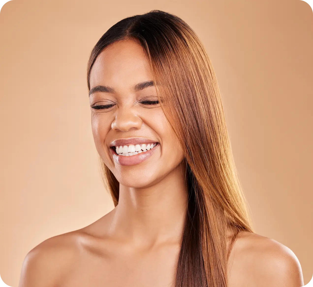 Smile / Laugh Line Filler